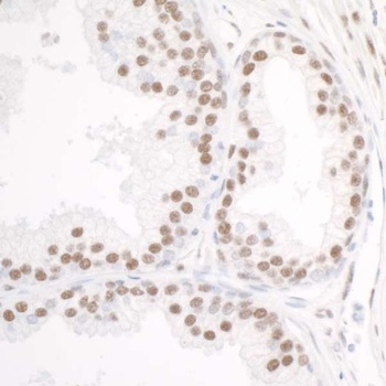 Rabbit anti-DDX5 Antibody
