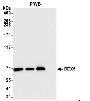 Rabbit anti-DDX5 Antibody