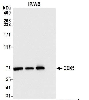 DDX5 Antibody