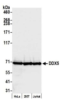 Rabbit anti-DDX5 Antibody