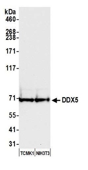 Rabbit anti-DDX5 Antibody