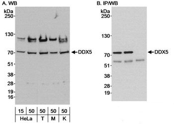 Rabbit DDX5 Antibody
