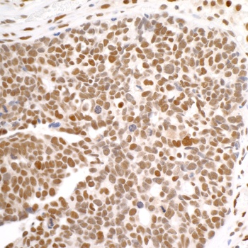 Rabbit anti-DDX1 Antibody
