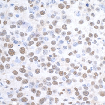 Rabbit anti-DDX1 Antibody