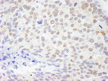 Rabbit anti-DDX1 Antibody