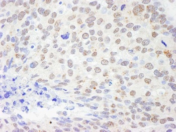 DDX1 Antibody