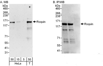 Rabbit anti-Roquin Antibody