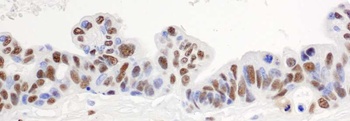 Rabbit anti-hnRNP-H Antibody