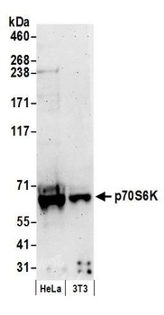 Rabbit p70S6K Antibody