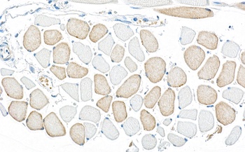 Rabbit anti-AMPK alpha 1 Antibody