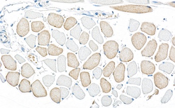 AMPK alpha 1 Antibody