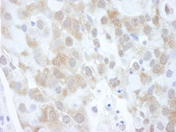 Rabbit 4EBP1 Antibody