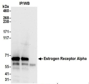 Rabbit Estrogen Receptor Alpha Antibody