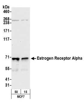 Rabbit Estrogen Receptor Alpha Antibody