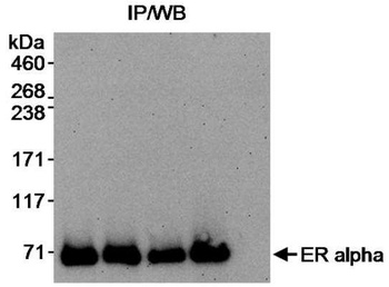 Rabbit Estrogen Receptor Alpha Antibody