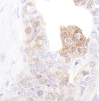 Rabbit CamK4 Antibody