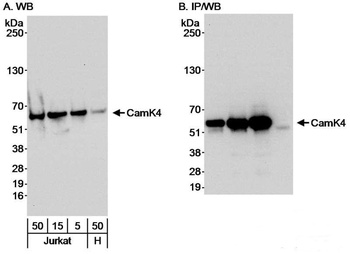 Rabbit CamK4 Antibody
