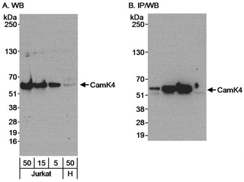 Rabbit CamK4 Antibody