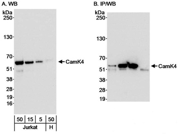 Rabbit CamK4 Antibody