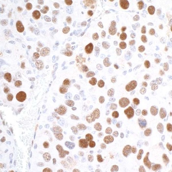 RCH1/KPNA2 Antibody