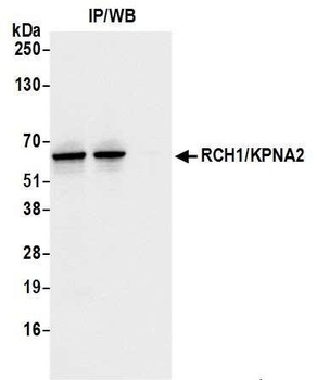RCH1/KPNA2 Antibody