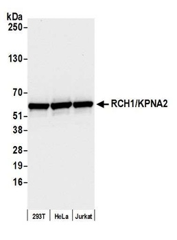 RCH1/KPNA2 Antibody