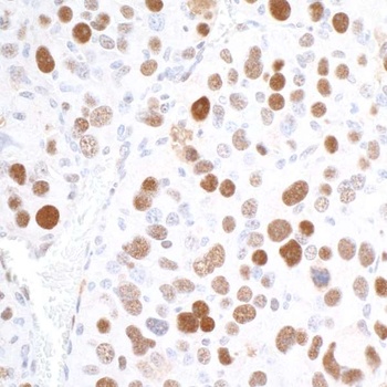 Rabbit anti-RCH1/KPNA2 Antibody