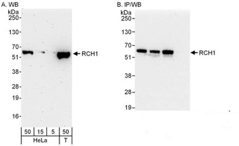 Rabbit anti-RCH1/KPNA2 Antibody