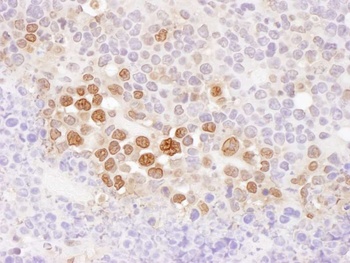 Rabbit anti-CSE1 Antibody
