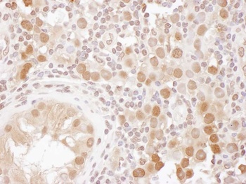 Rabbit anti-CSE1 Antibody