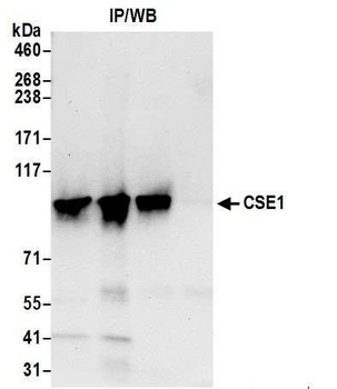 CSE1 Antibody