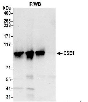 Rabbit anti-CSE1 Antibody