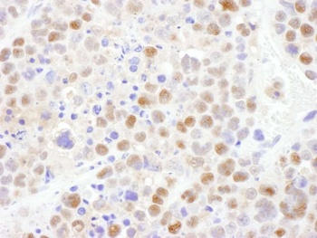 CRM1 Antibody