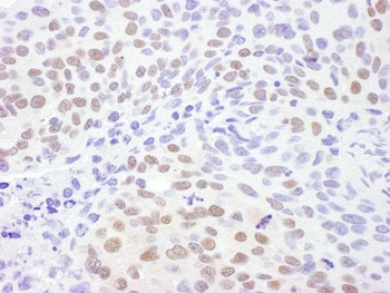 Rabbit CRM1 Antibody