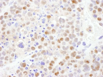 Rabbit CRM1 Antibody