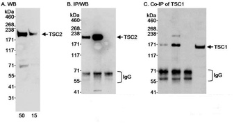 Rabbit TSC2 Antibody