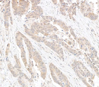 Rabbit anti-DDX6 Antibody