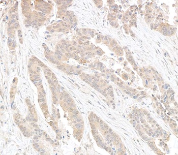 DDX6 Antibody