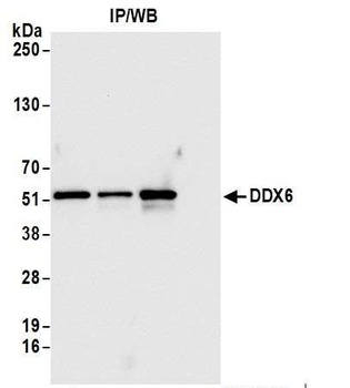 DDX6 Antibody