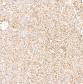 Rabbit anti-DDX6 Antibody