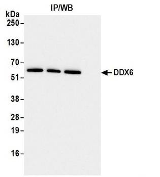 DDX6 Antibody