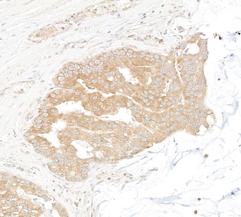 Rabbit anti-DDX6 Antibody