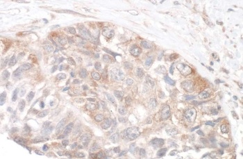 Rabbit anti-Rictor Antibody