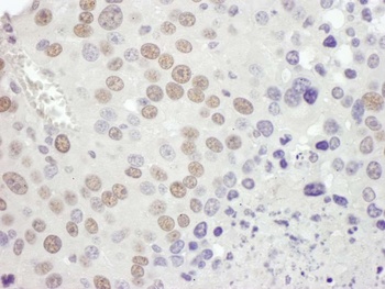 Rabbit anti-MSH2 Antibody