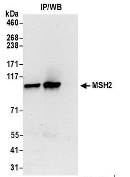 Rabbit anti-MSH2 Antibody