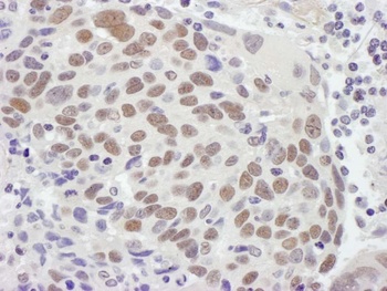 Rabbit anti-MSH2 Antibody