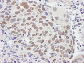 MSH2 Antibody