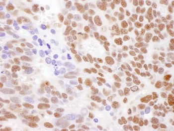 Rabbit anti-RecQ1 Antibody