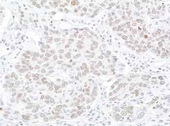 Rabbit anti-WSTF Antibody