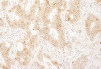 Rabbit Paxillin Antibody